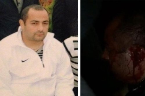 Lənkərasnkiyə qarşı döyüşən azərbaycanlı “oğru”nun elə yerini kəsdilər ki... - FOTOLAR (+18)