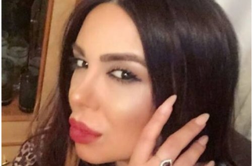 Dodaqlarındakı silikondan azad olandan sonra pişik Günel - FOTOLAR