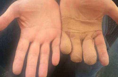 Polisdən DƏHŞƏTLİ İŞGƏNCƏ ! Lüt soyundurub, 3 barmağın qopardılar - FOTOLAR