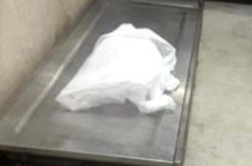 DƏHŞƏT: yeni doğulmuş uşağın qollarını kəsdilər - FOTO