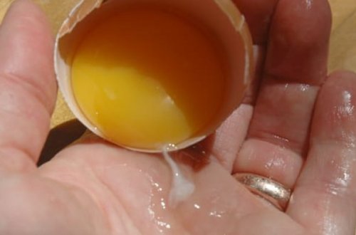 Yumurta sarısındakı ağ 