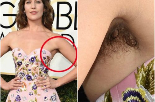 Məşhur aktrisa BİABIR OLDU: Qolunun altı ... - FOTOLAR