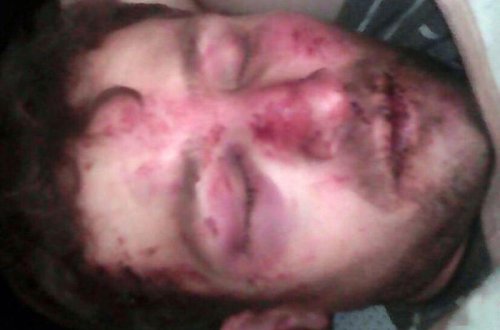 Goranboy sakinini huşunu itirənə qədər döydülər - FOTOLAR