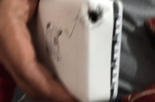 Çoxlarının istifadə etdiyi cihaz bir anda partladı, ağır yaralanan var