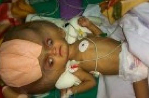 DÜNYANIN ƏN BÖYÜK başına SAHİB İDİ! BAXIN başının içindən NƏLƏR ÇIXDI - ŞOK FOTOLAR