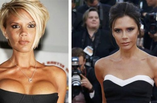 Viktoriya Bekhem sinəsini böyütdüyü üçün PEŞMAN OLDU və... - FOTOLAR