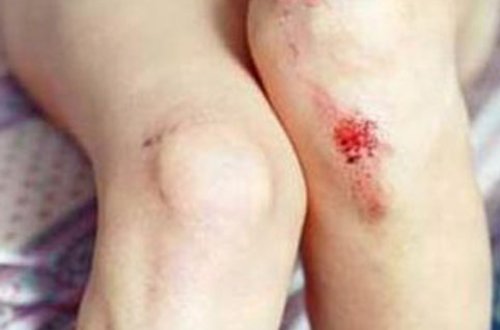 Sevgilisini qəbristanlıqda bıçaqladı, sonra təcavüz etdi - FOTO