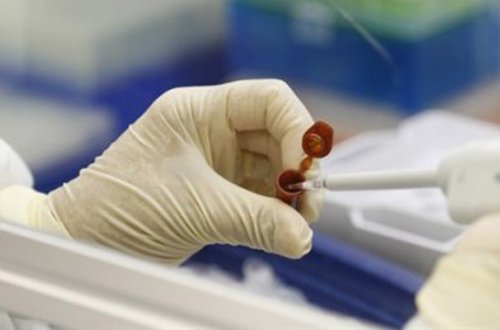 Azərbaycanda peyvənd neçəyədir?