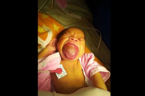 Belə doğuldu: həkimlər də gördüklərindən ŞOK OLDU - FOTOLAR