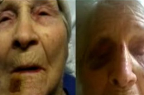 Tibb bacıları onları köməyə çağıran nənəni döyür, dil çıxararaq onu lağa qoyurlar- GİZLİ KAMERA