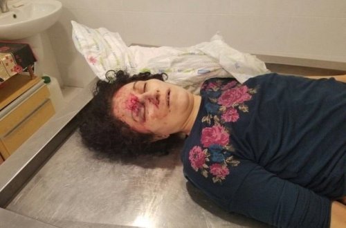 DİQQƏT ! Mərdəkanda qadını öldürdülər - cəsədi ortalıqda qalıb, TANIYAN ŞƏXSLƏR KÖMƏK EDİN (+18 FOTO)