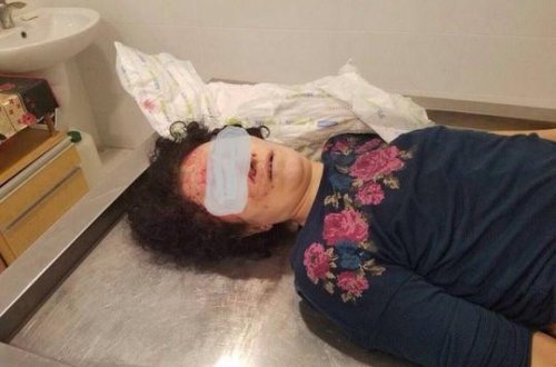 Özünü körpüdən atan qadın barədə - Təfərrüatlar