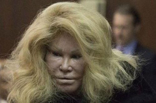 Estetik əməliyyatlarla tanınmaz hala düşmüşdü, indi də evini satır - FOTO