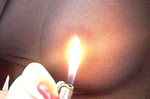 Cinsi bərabərsizliyə belə etiraz etdi -  Sinəsini yandırdı- FOTO