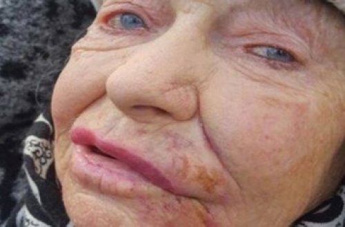 Bakıda məşhur şəxsiyyətin gəlininə qarşı vəhşilik - Foto