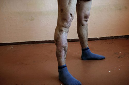 QORXUNC: Bu maddə çürüdür: Zombiyə çevrilən insan 2 ildə ölür - VİDEO