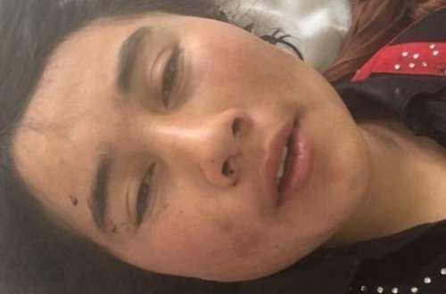 Əfqanıstanda qısqanc ər arvadının qulaqlarını kəsib – FOTO