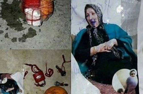 Bulvarda cadu tapıldı: Üstünə sancılmış iynə, qıfıl... - FOTO