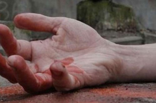 22 yaşlı oğlan qollarını kəsdi