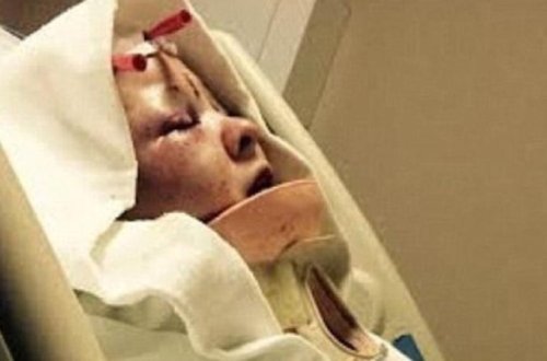 Sevgilisinə qarşı DƏHŞƏTLİ HƏRƏKƏT: baş dərisini qopardı, iti ilə...