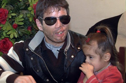 Azərbaycanlı gənc gözlərini sevgisinə qurban verdi: Övladlarımı həyatda görməsəm də, yuxuda görürəm