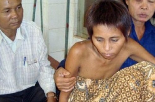 Göyərçin oğlan, canavar qızlar, toyuq uşaq - Vəhşi heyvanların böyütdüyü insanlar - FOTO+VİDEO