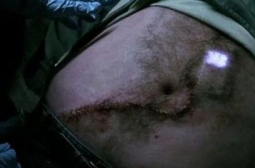 Gənc oğlan mobil telefon uddu – VİDEO