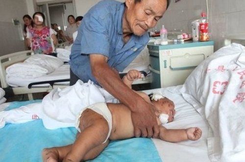 Ana övladına qida verən zaman üzünü qayçı ilə 90 dəfə kəsib