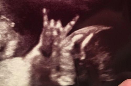 Hamilə qadın şokda: qarnında 