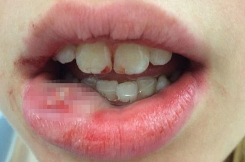 Həkim 13 yaşlı qızı 