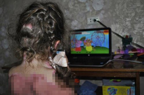 Valideynlər, DİQQƏT: uşaqlarınızı bu oyundan qoruyun - 5 yaşlı qız oyunun qurbanı oldu - FOTOLAR