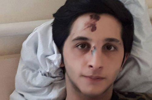 Faciəvi qəzada yaralanan Əfsər: 