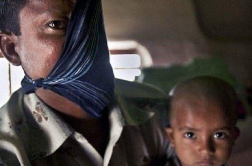 20 il əvvəl pələng hücumuna məruz qalan şəxs üzünü nümayiş etdirdi - FOTOLAR