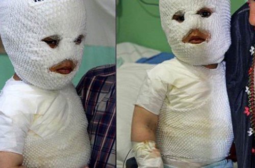 Sumqayıtda DƏHŞƏT: 6 yaşlı uşaq yanaraq öldü