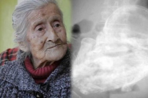 60 ildir hamilə imiş - Tibb dünyası ŞOKDA