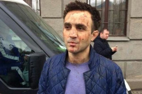 Metrodakı terrorda yaralanan Zaur: 