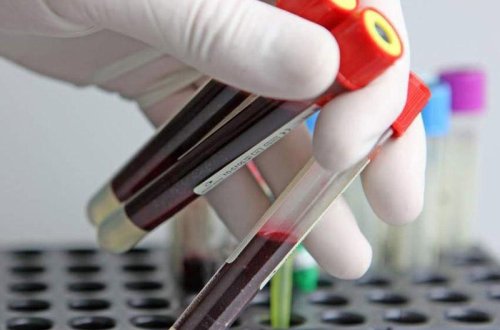 Rusiyadan Azərbaycana məhsul idxalına qadağa qoyula bilər? - RƏSMİ AÇIQLAMA