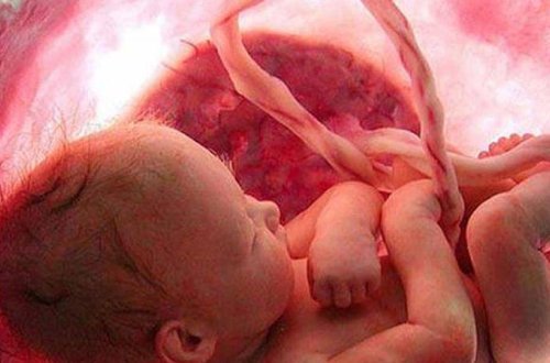 Əkiz uşaqların ana bətnində etdiyi hərəkət hamını HEYRƏTLƏNDİRDİ - FOTO