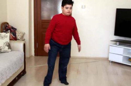 VƏHŞİLİK: Ayaqsız doğulan və ürəyində dəlik olan 10 yaşlı oğlanı döydülər - FOTO