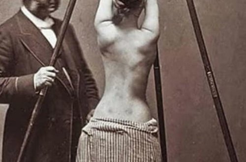 Ötən əsrin QORXUNC TİBB ÜSULLARI - FOTOLAR