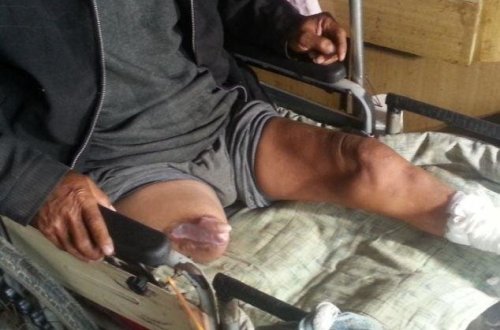 Avtomobil kişinin üstündən keçdi, ayaqları... - Bakıda QƏZA