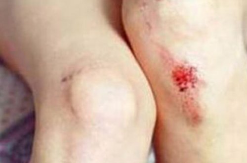 Şəhidlər xiyabanında 13 yaşlı qıza təcavüz edildi - FOTO