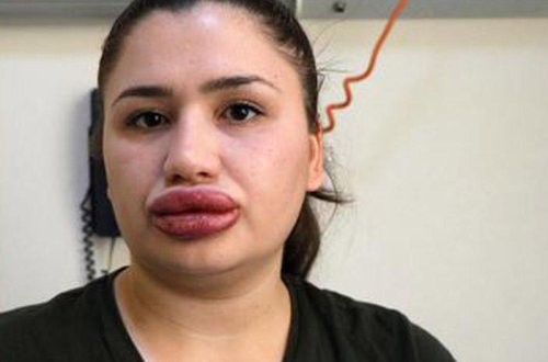 Azərbaycanda oxuyan türk 