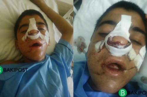 Müəllim şagirdi qanına qəltan elədi, həkimlər başına oyun açdı - Tükürpədici olay/ FOTOLAR