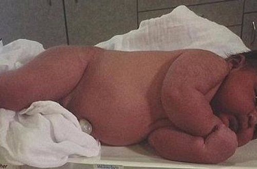 Dünya şokda! Anasının qarnından belə çıxdı - FOTO