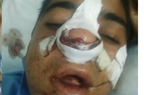 Şagirdi vəhşicəsinə döyüb şikəst edən müəllimin məhkəməsi başladı