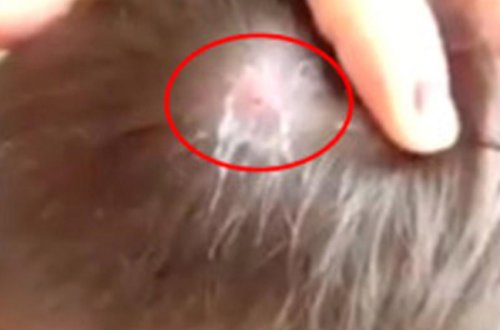 Oğlanın başından çıxan əşya görənləri dəhşətə gətirdi -VİDEO