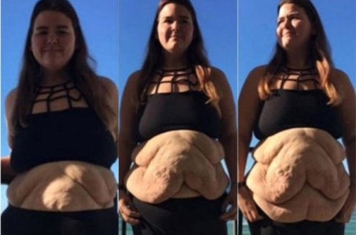 83 kiloqram arıqladı - İNANILMAZ GÖRKƏM ALDI - FOTOLAR