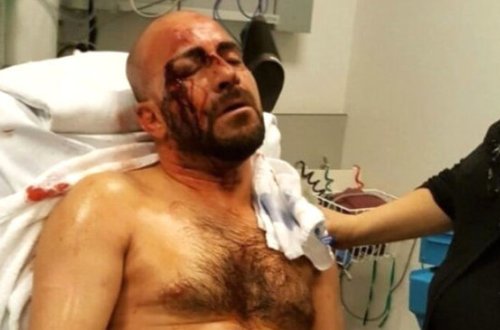 Belçikada Ərdoğan tərəfdarını vəhşicəsinə döydülər - FOTO