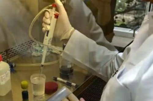 SON DƏQIQƏ! DÜNƏNDƏN AZƏRBAYCANI SILKƏLƏYƏN QORXULU MESAJLA BAĞLI AÇIQLAMA: 